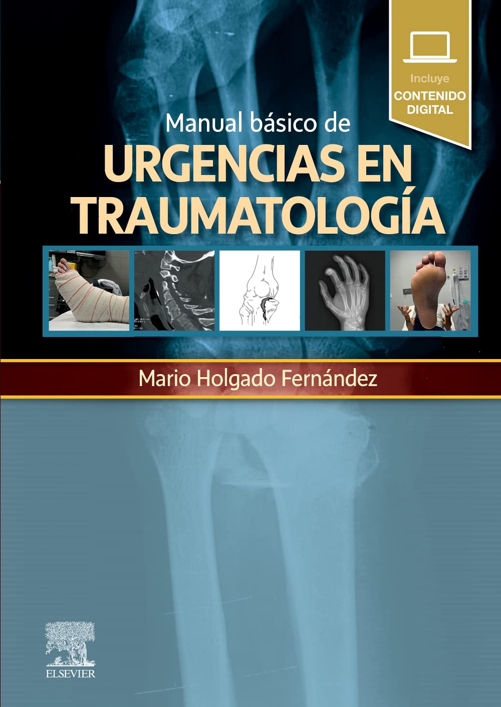 Libro: Manual básico de urgencias en traumatología