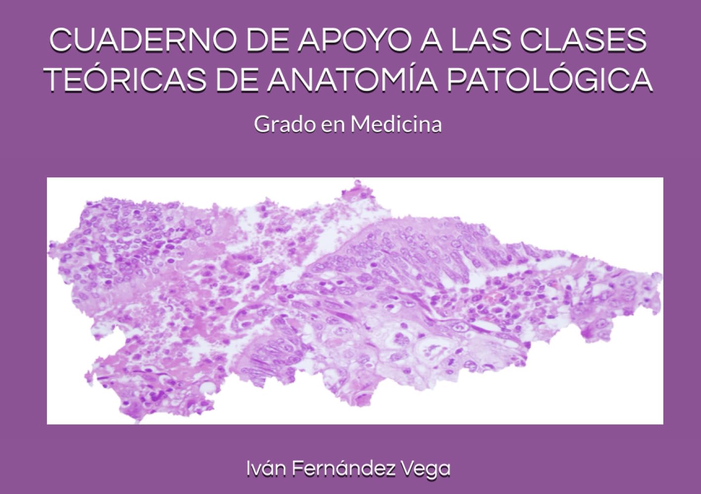 Libro: CUADERNO DE APOYO A LAS CLASES TEÓRICAS DE ANATOMÍA PATOLÓGICA: GRADO EN MEDICINA (Spanish Edition)