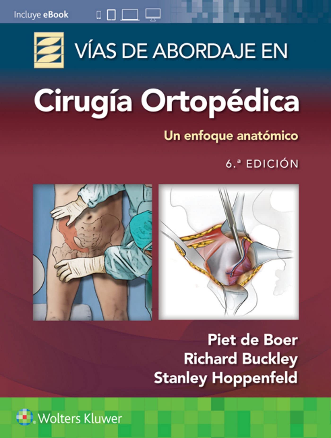 Libro: Vías de abordaje de cirugía ortopédica. Un enfoque anatómico (Spanish Edition)