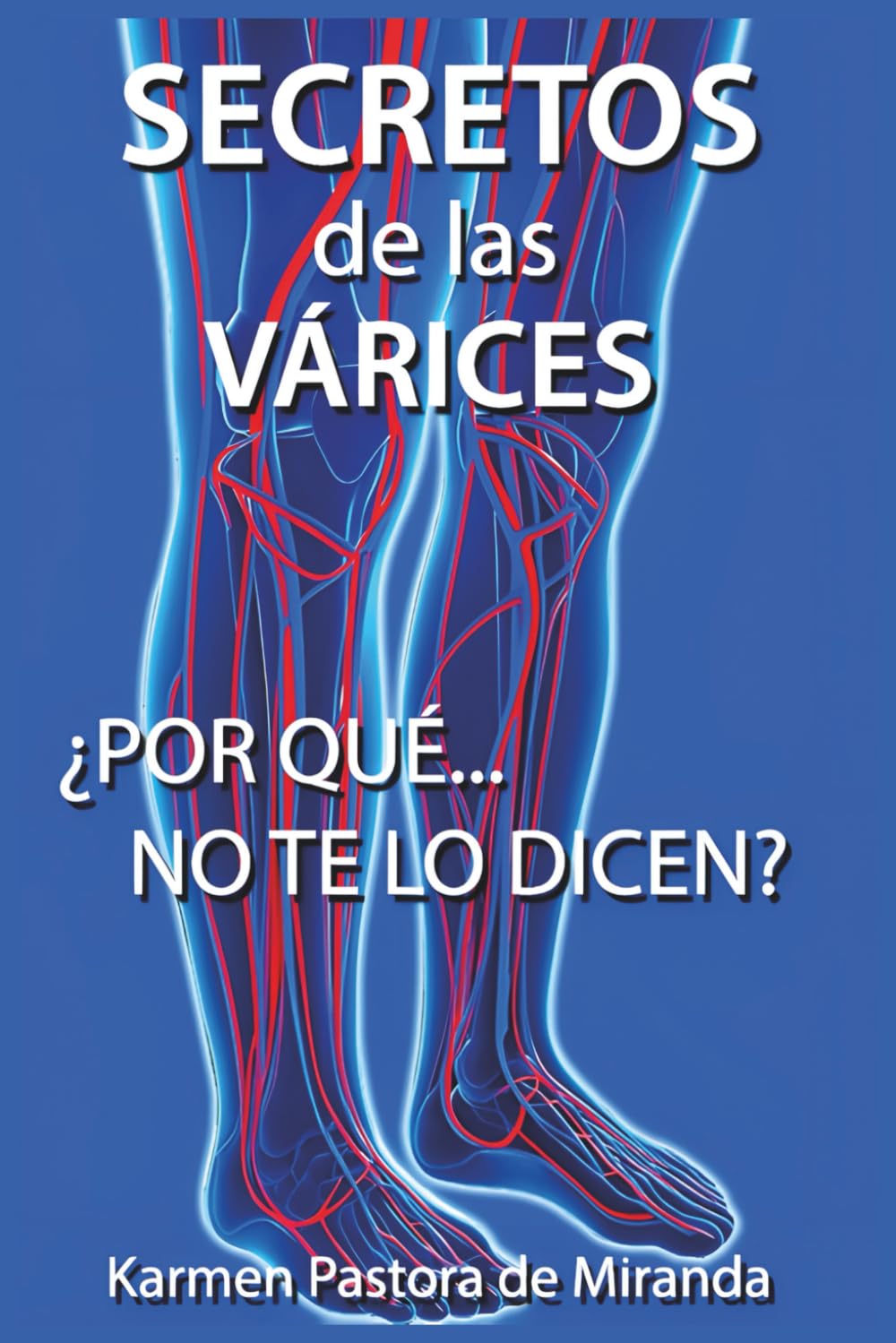 Libro: Secretos de las Varices: ¿Porque no te lo dicen? (Spanish Edition)