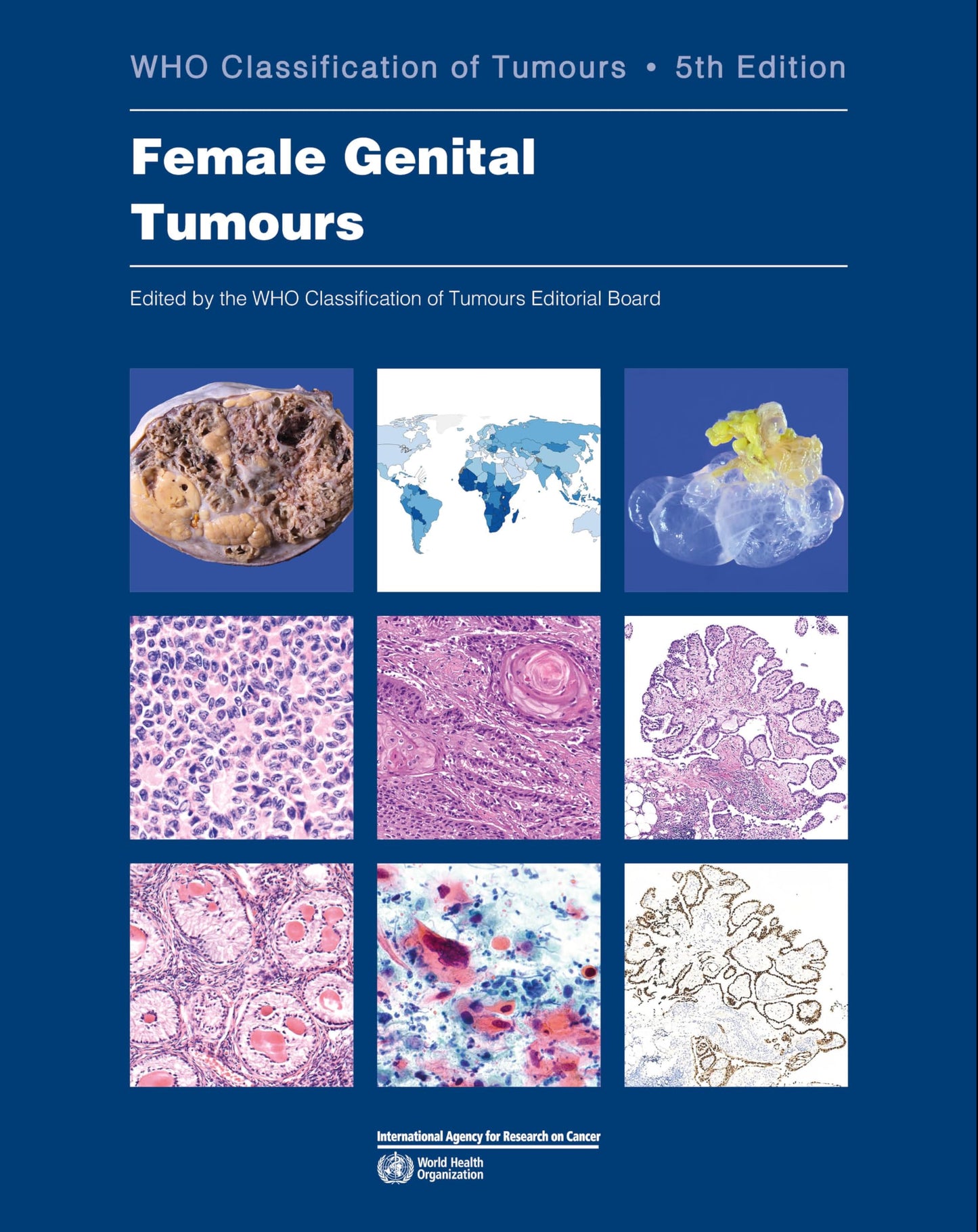 Libro: Female Genital Tumours: WHO Classification of Tumours (Medicine)