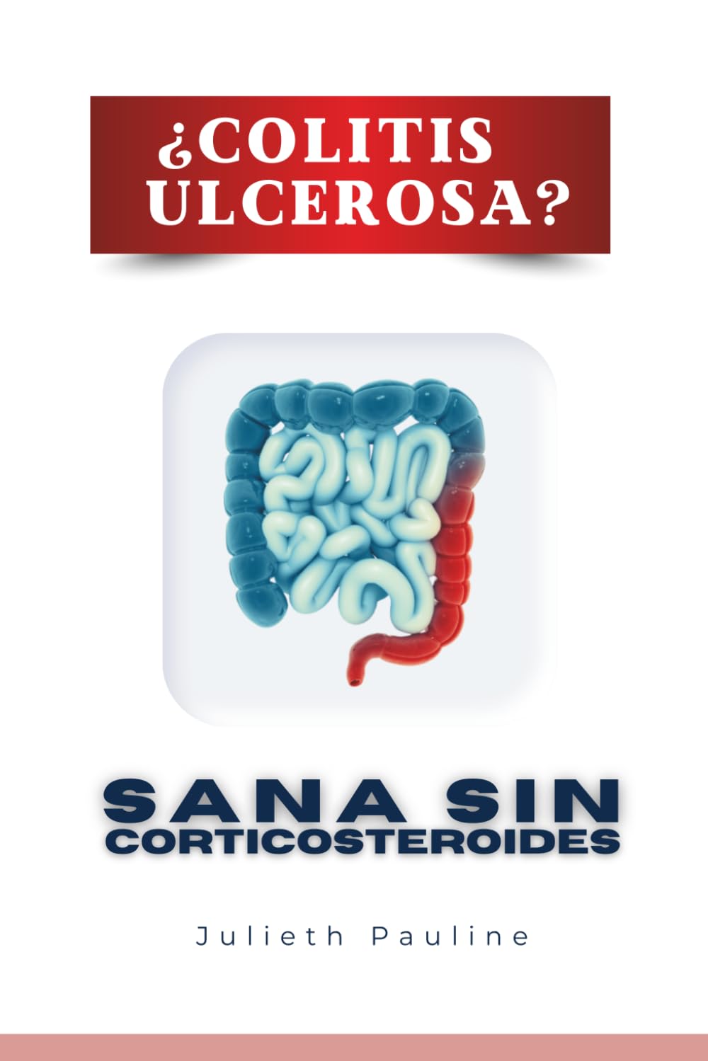 Libro: ¿COLITIS ULCEROSA?: ¡Sana Sin Corticosteroides! (Spanish Edition)