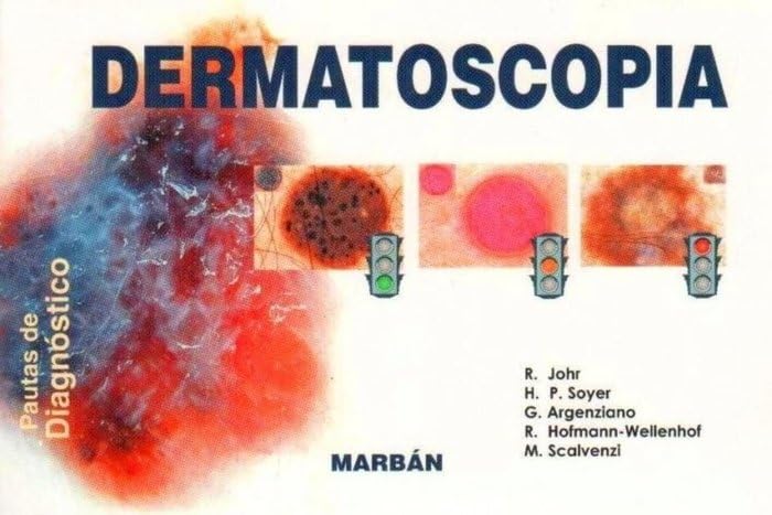 Libro: Dermatoscopia. Pautas de diagnostico