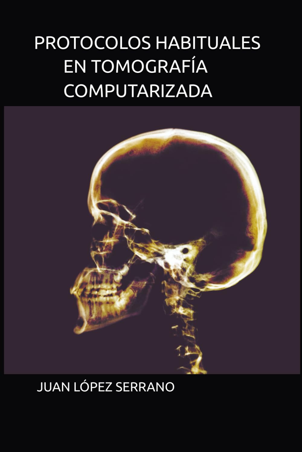 PROTOCOLOS HABITUALES EN TOMOGRAFIA COMPUTERIZADA