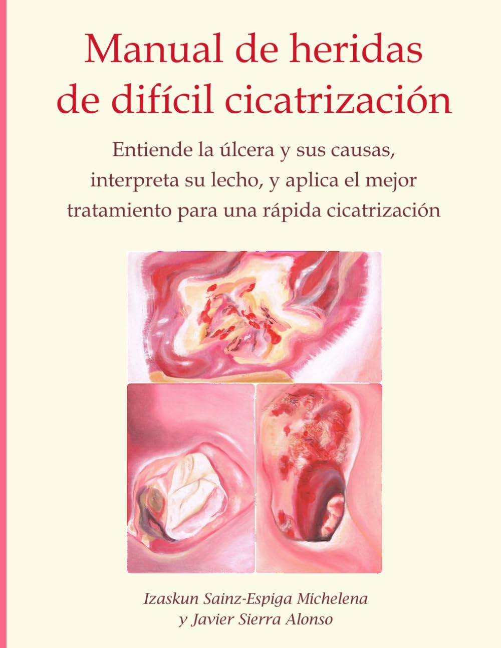 Libro: Manual de heridas de difícil cicatrización: Entiende la úlcera y sus causas, interpreta su lecho, y aplica el mejor tratamiento para una rápida cicatrización