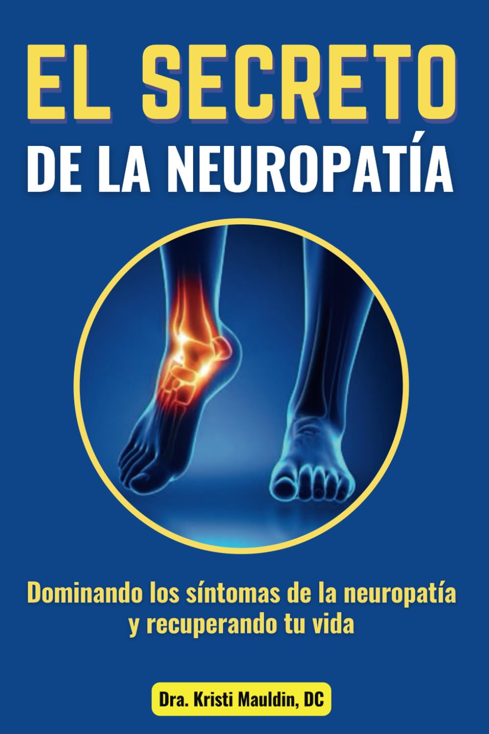 Libro: EL SECRETO DE LA NEUROPATÍA:: Dominando los síntomas de la neuropatía y recuperando tu vida (Spanish Edition)