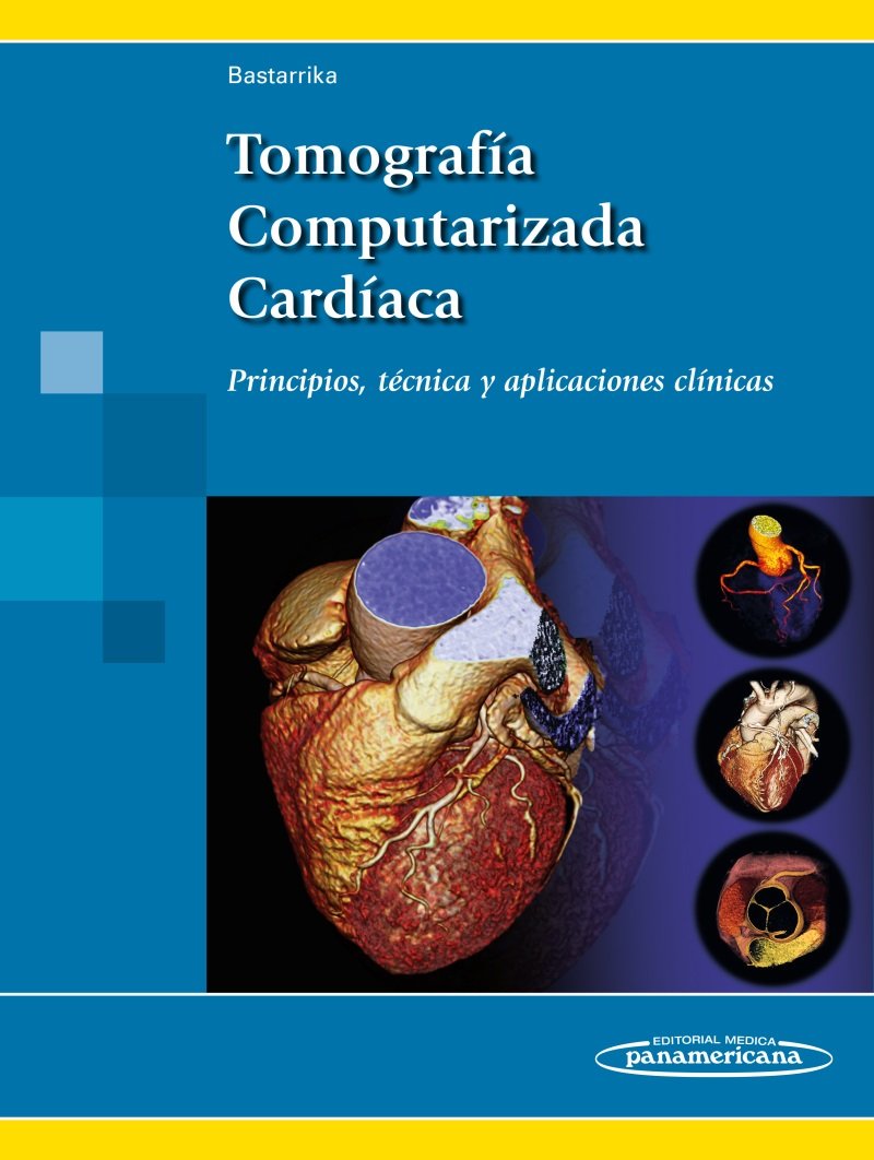 Libro: Tomografía Computarizada Cardíaca. Principios, técnica y aplicaciones clínicas