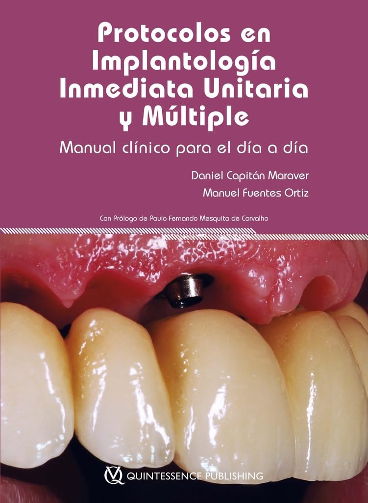Libro: Protocolos en Implantología Inmediata Unitaria y Múltiple. Manual Clínico para el Día a Día