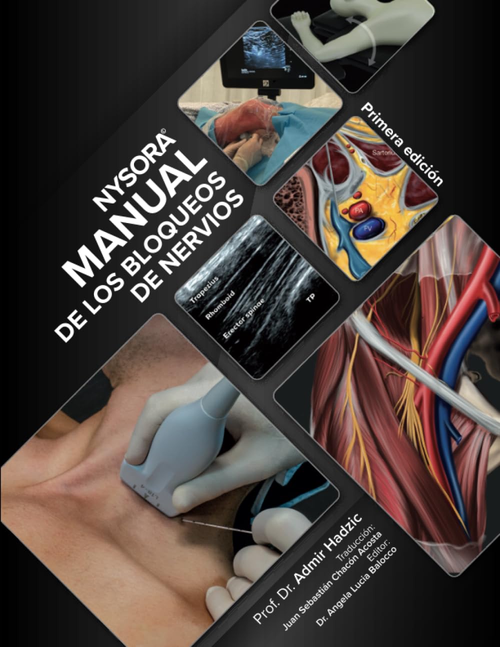 Libro: NYSORA Manual de los Bloqueos de Nervios: Primera Edición (Spanish Edition)