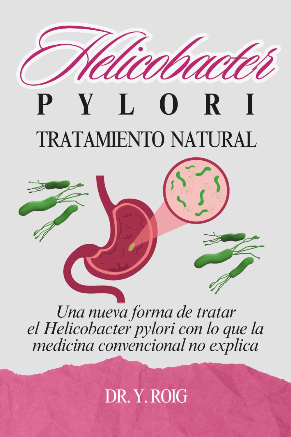Libro: Helicobacter Pylori Tratamiento Natural: Una nueva forma de tratar el Helicobacter pylori con lo que la medicina convencional no explica (Remedio para la gastritis)