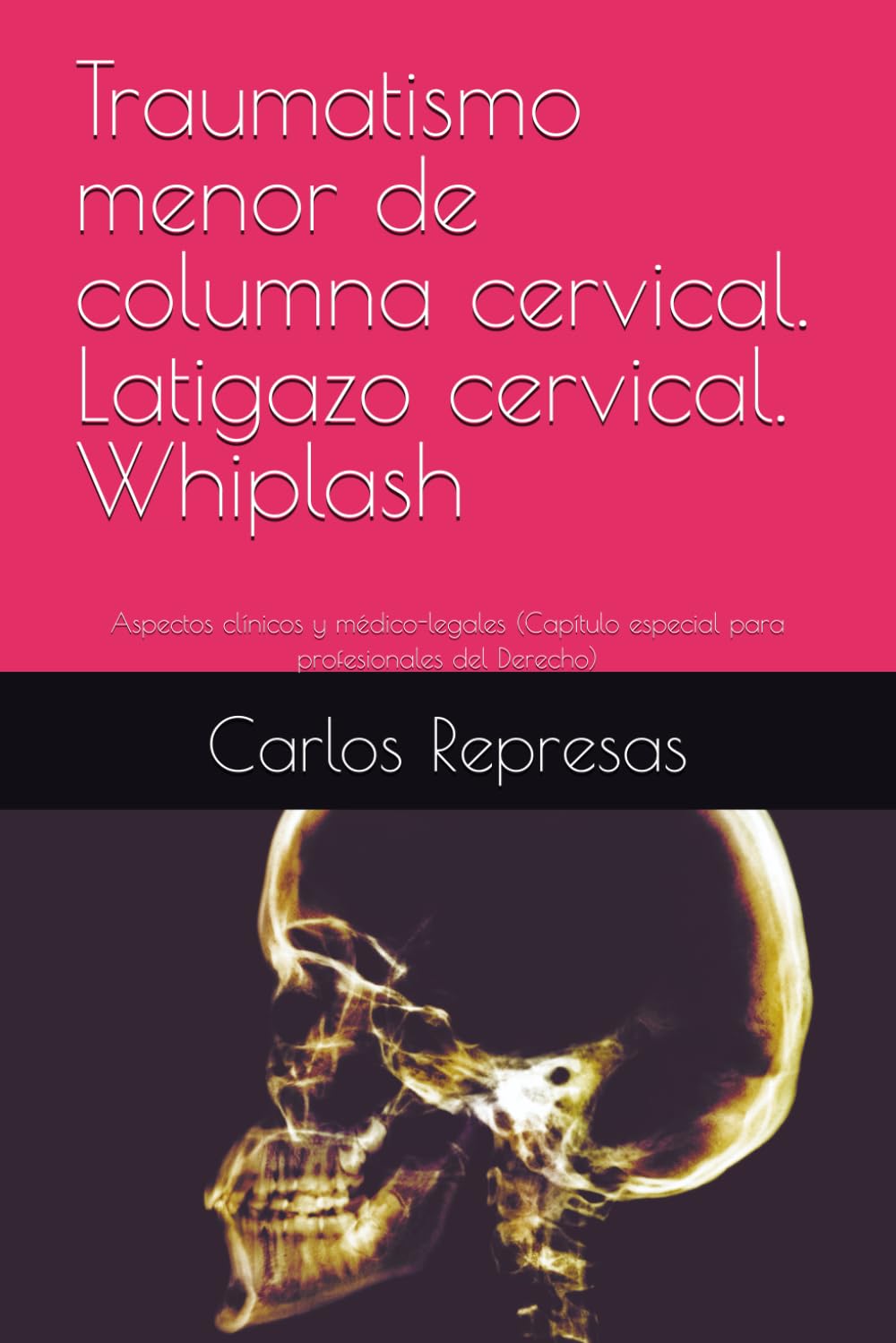 Libro: Traumatismo menor de columna cervical. Latigazo cervical. Whiplash: Aspectos clínicos y médico-legales (Capítulo especial para profesionales del Derecho) (Spanish Edition)