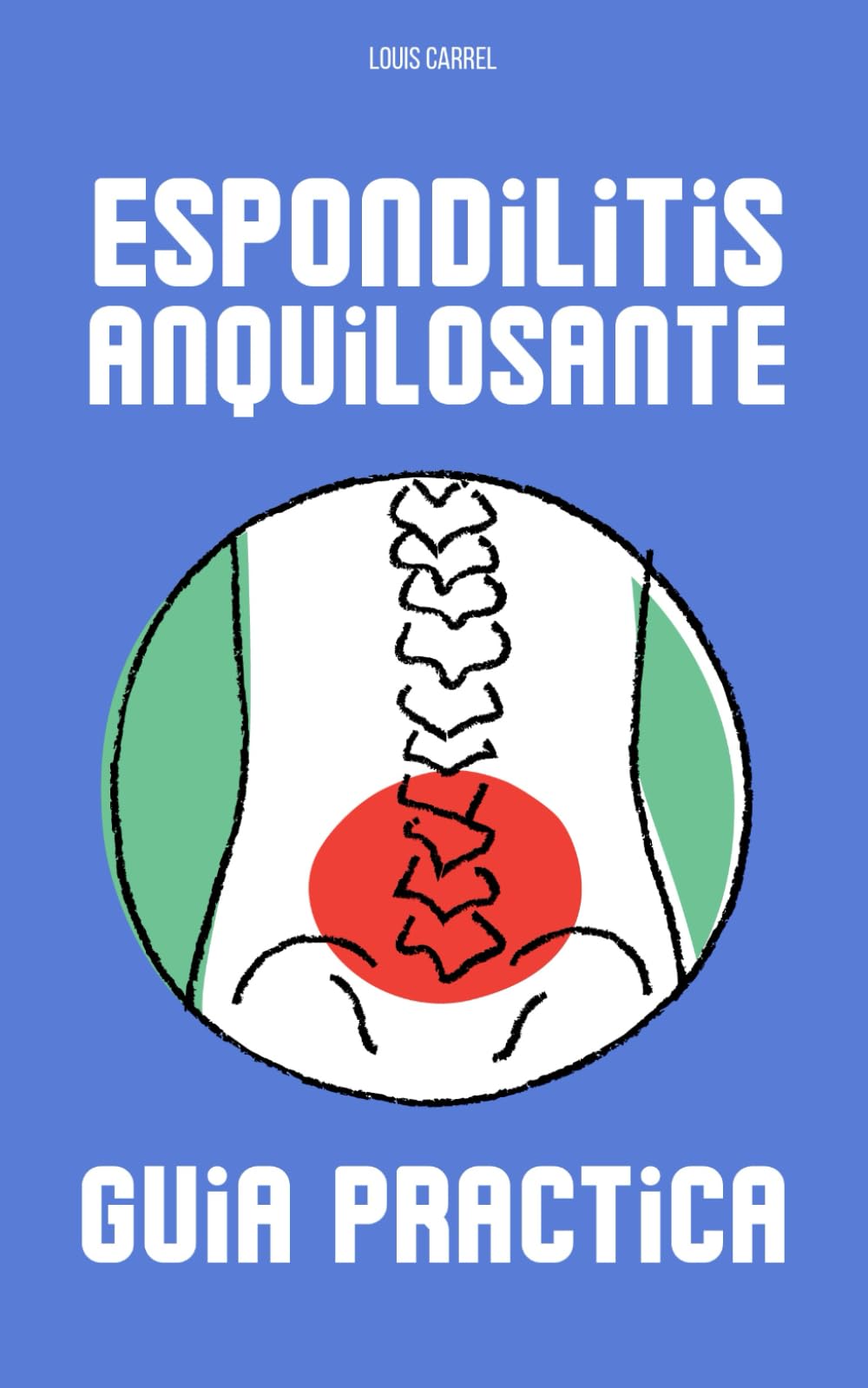 Libro: ESPONDILITIS ANQUILOSANTE : Guia practica: Cómo afrontar el dolor crónico y encontrar fuerza en la resiliencia