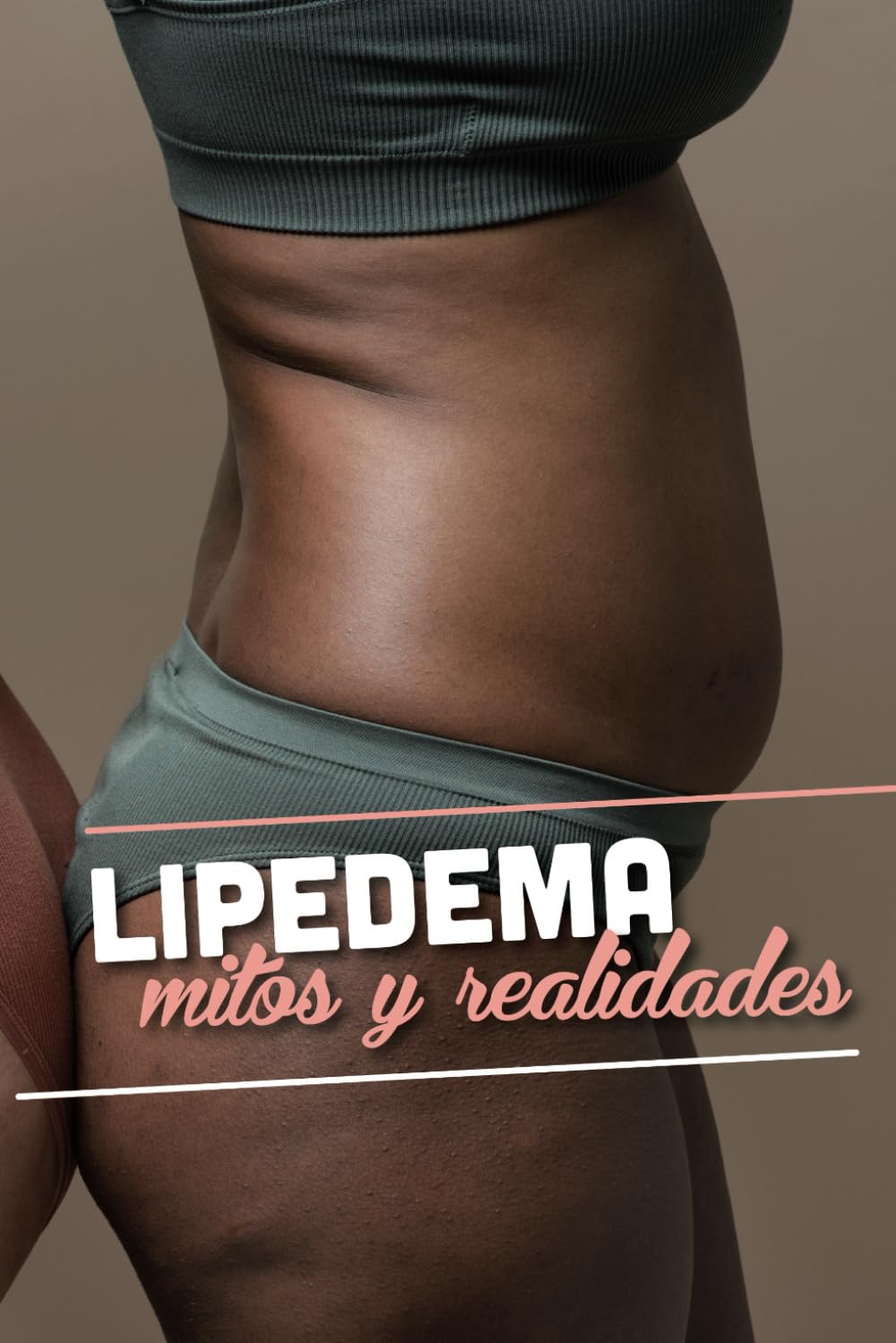 Libro: LIPEDEMA: Mitos y Realidades