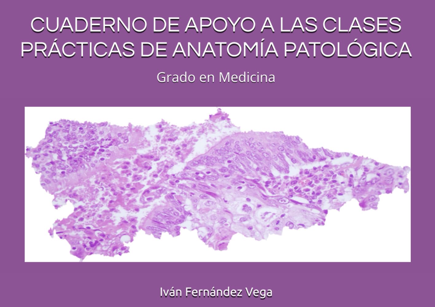 Libro: CUADERNO DE APOYO A LAS CLASES PRÁCTICAS DE ANATOMÍA PATOLÓGICA (Spanish Edition)