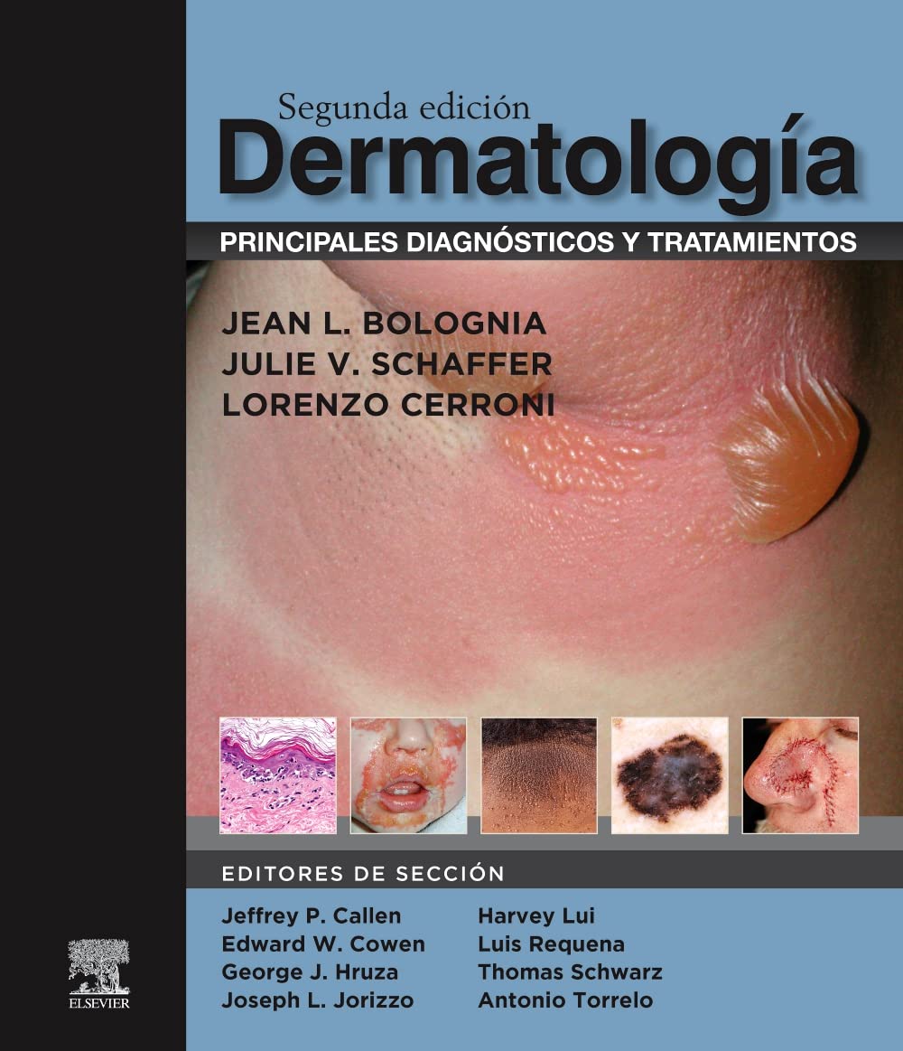 Libro: Dermatología: principales diagnósticos y tratamientos, 2.ª Edición