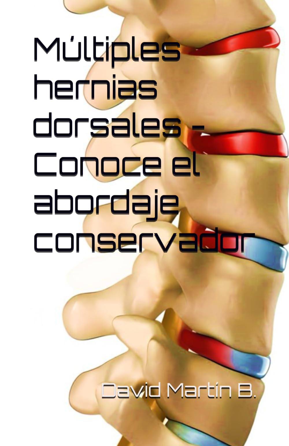 Libro: Múltiples hernias dorsales - Conoce el abordaje conservador (Spanish Edition)