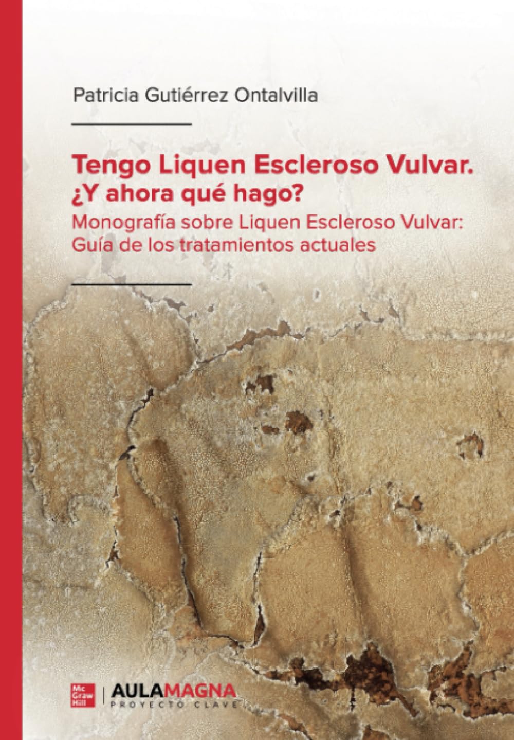 Tengo Liquen Escleroso Vulvar. ¿Y ahora qué hago?: Monografía sobre Liquen Escleroso Vulvar: Guía de los tratamientos actuales (SIN COLECCION)
