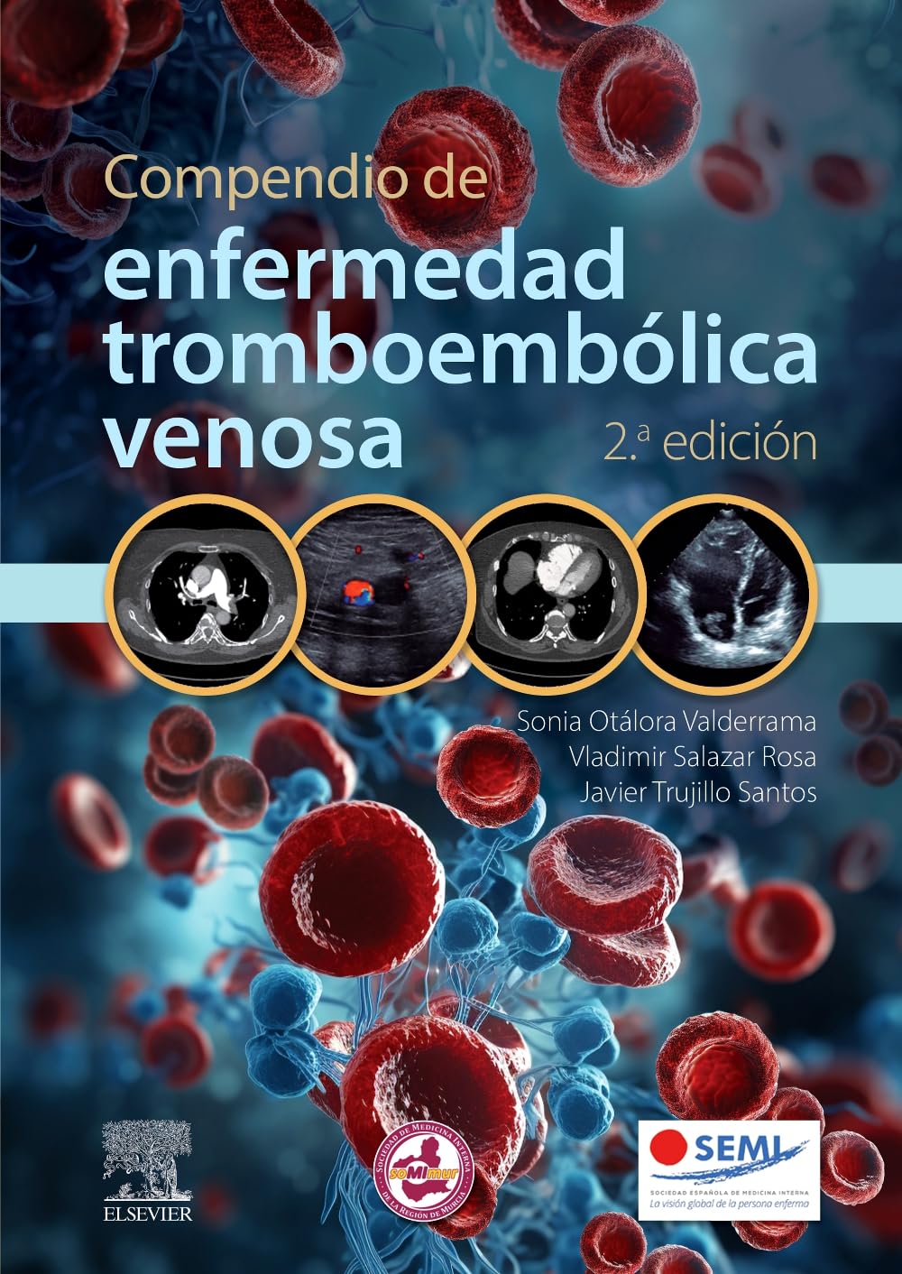 Libro: Compendio de enfermedad tromboembólica venosa