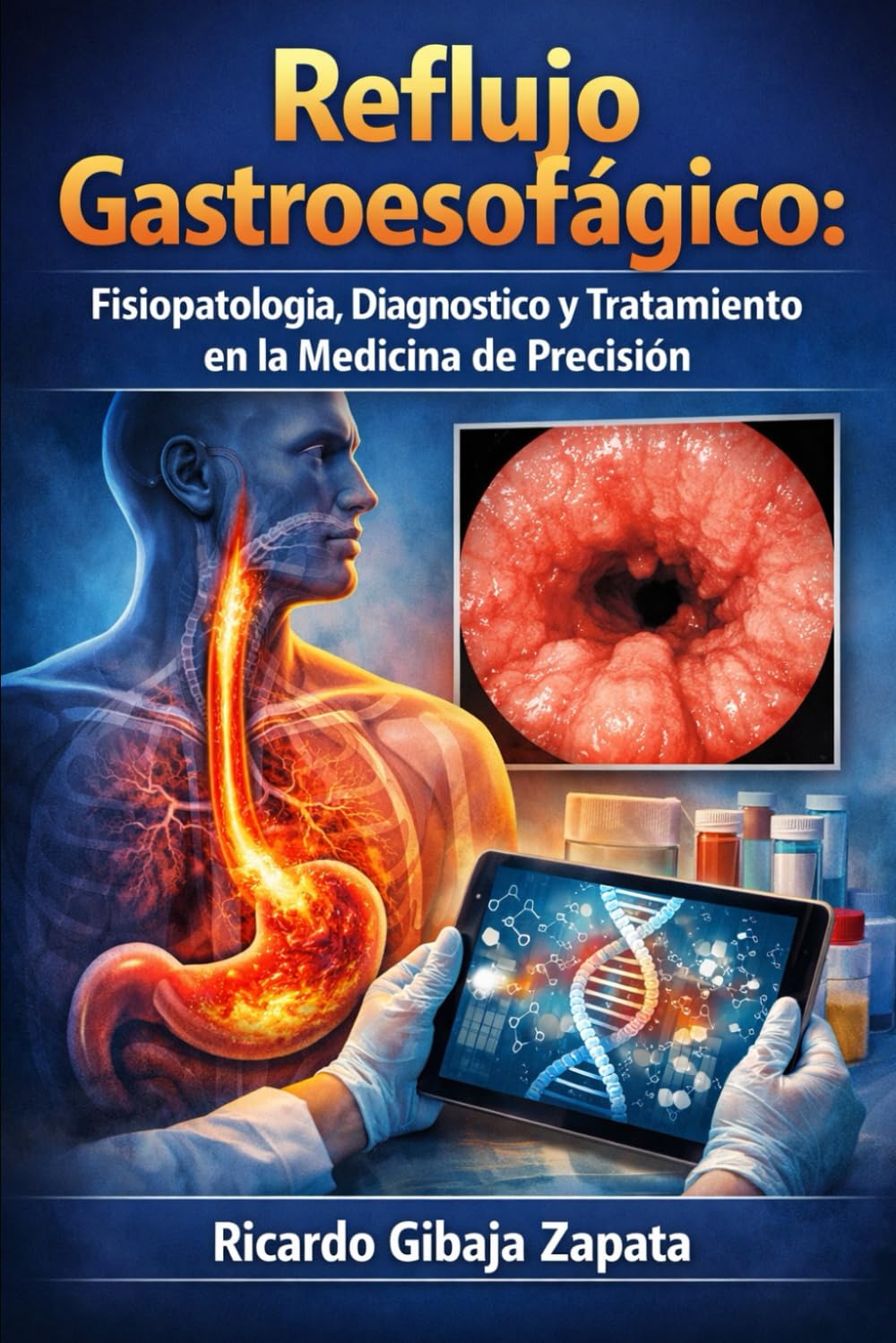 Libro: Reflujo Gastroesofágico: Fisiopatología, Diagnóstico y Tratamiento en la Medicina de Precisión