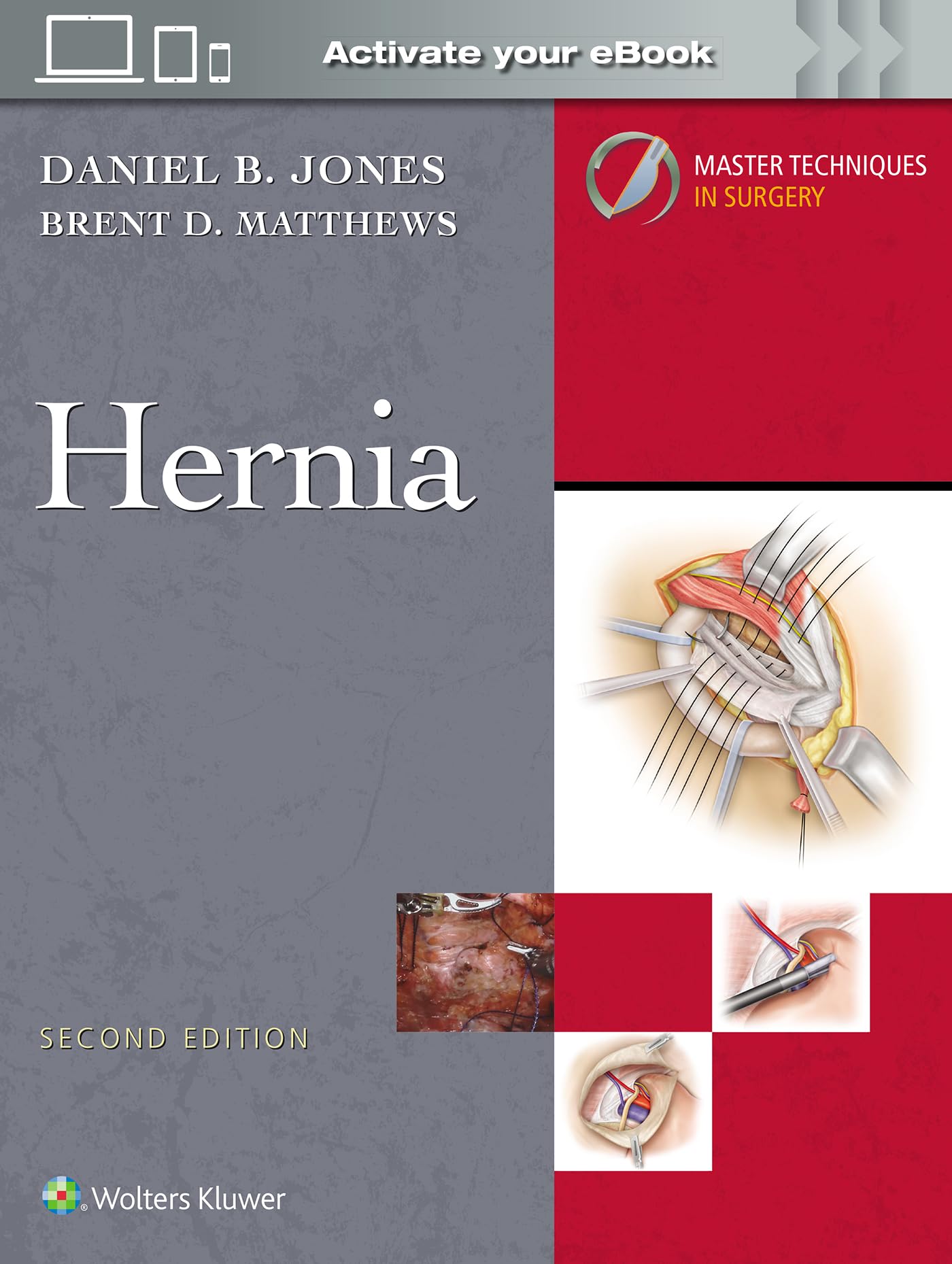 Libro: Master Techniques in Surgery: Hernia: Print + eBook with Multimedia