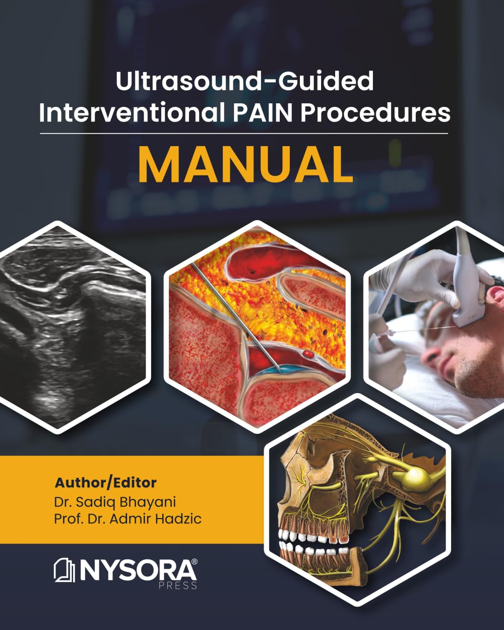Libro: Ultrasound-Guided Interventional Pain Procedures Manual