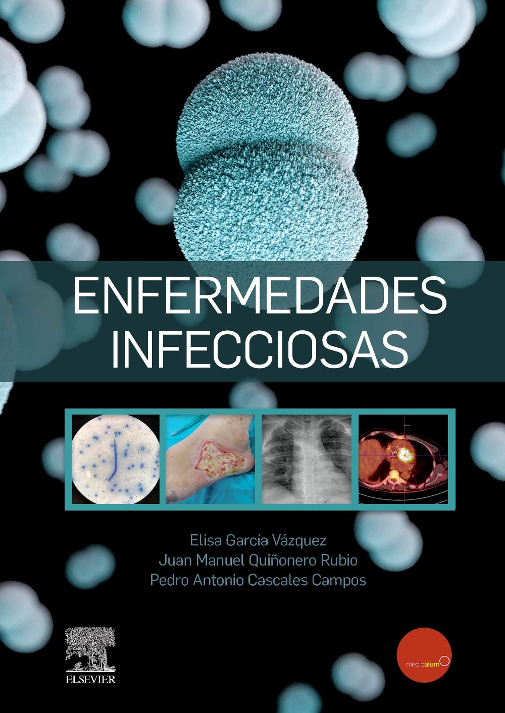 Libro: Enfermedades infecciosas