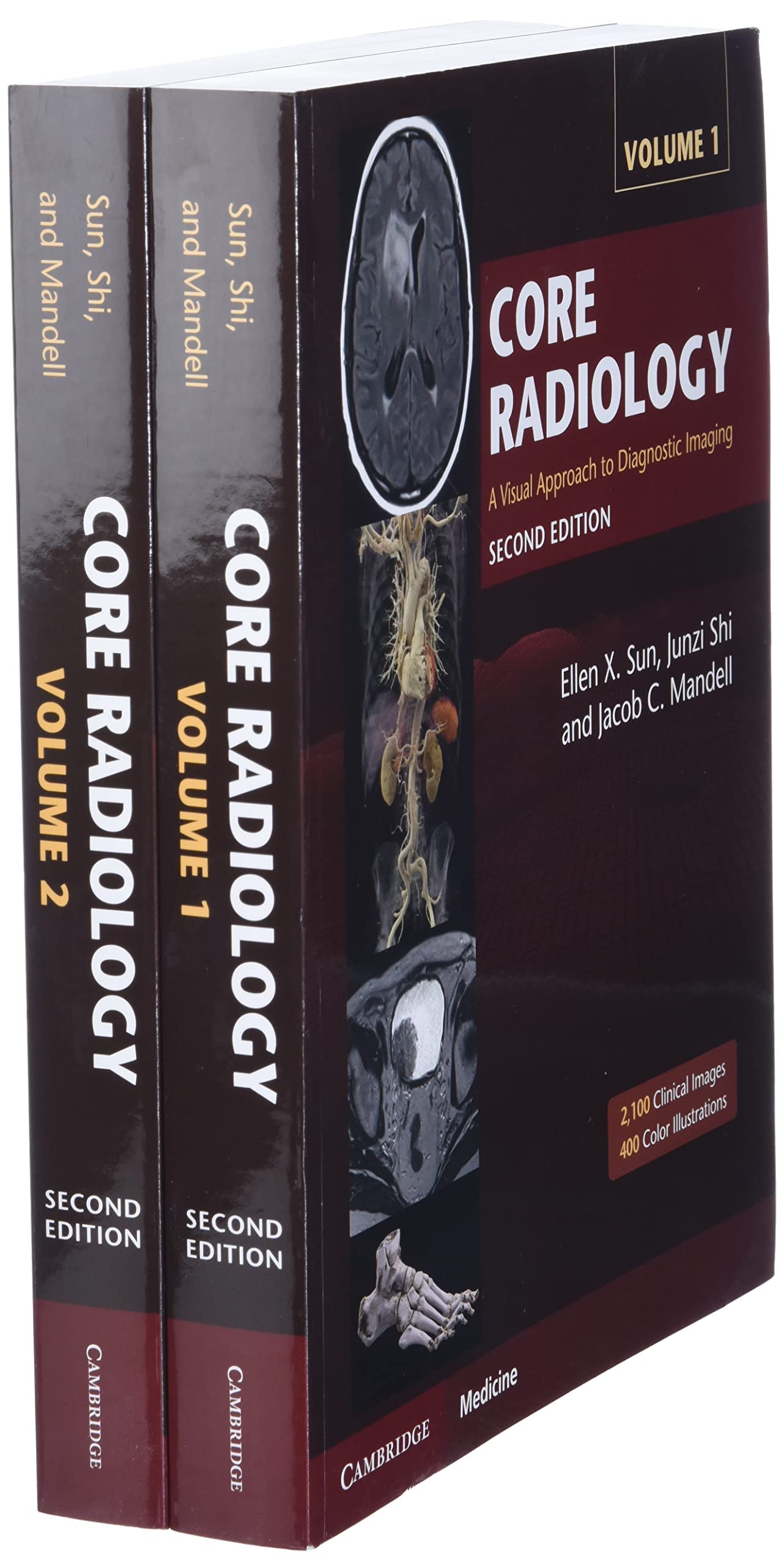Libro: Core Radiology: A Visual Approach to Diagnostic Imaging