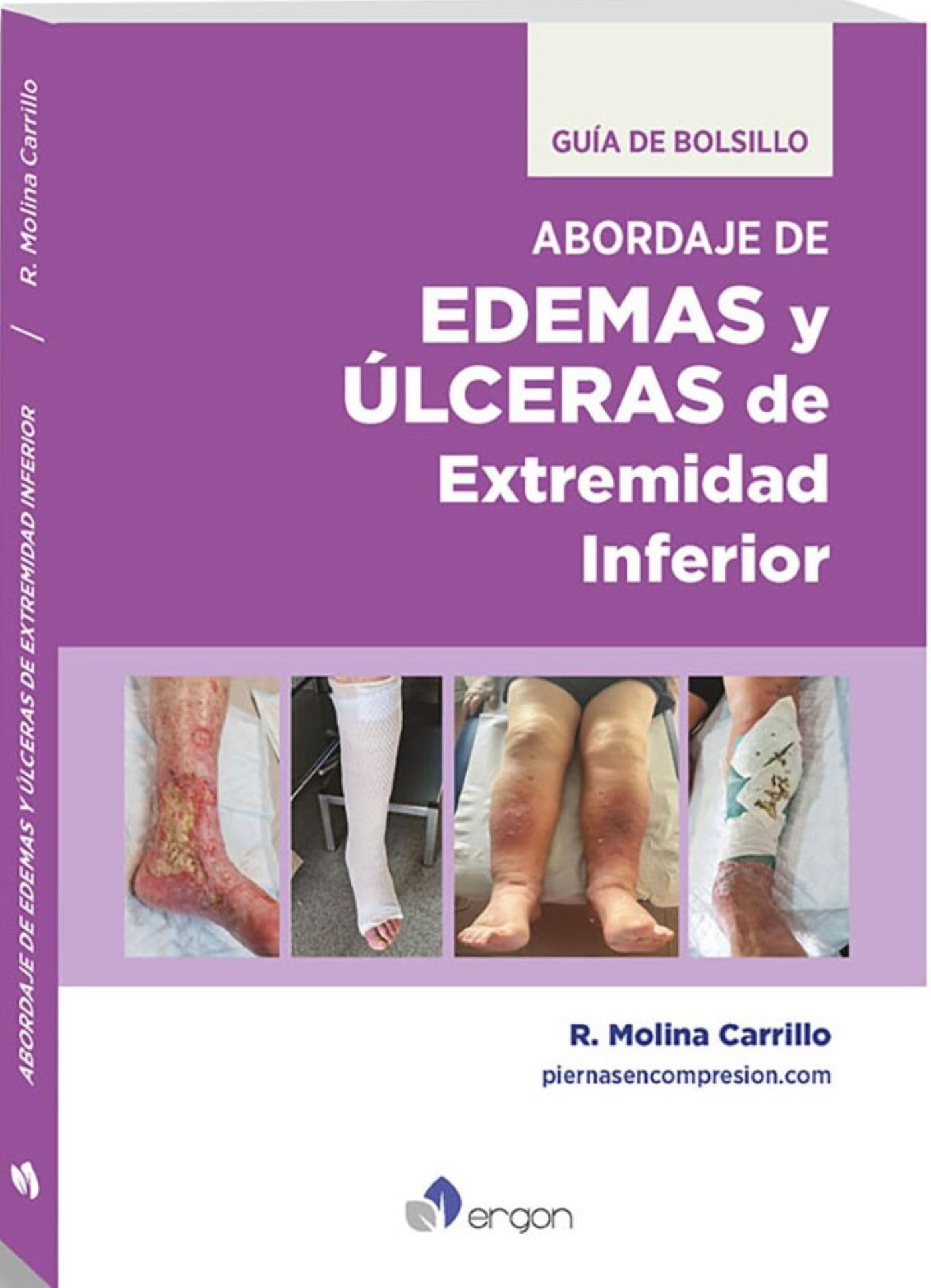Libro: Edemas y úlceras de extremidad inferior. Guía de bolsillo