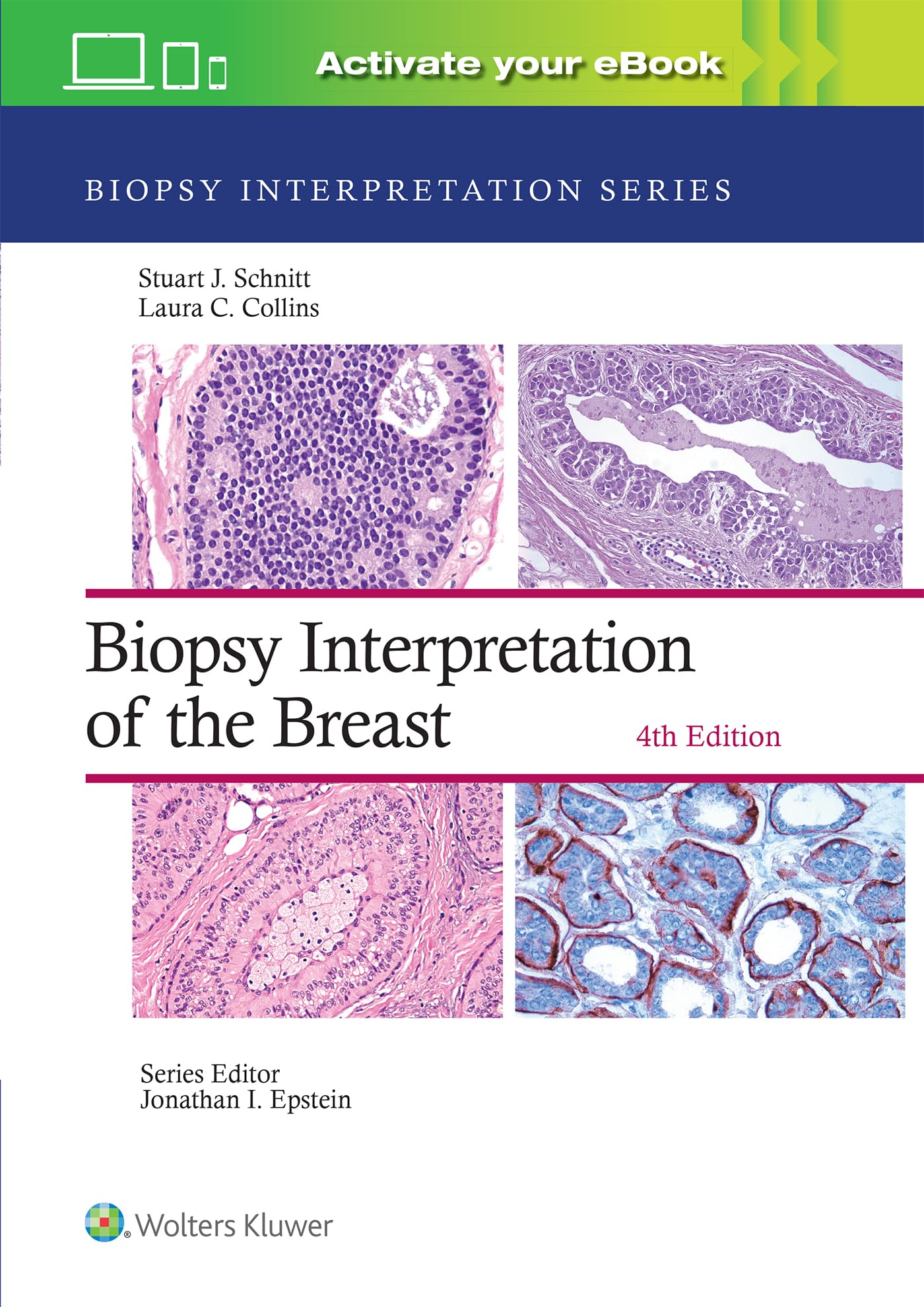 Libro: Biopsy Interpretation of the Breast: Print + eBook with Multimedia (Biopsy Interpretation Series)