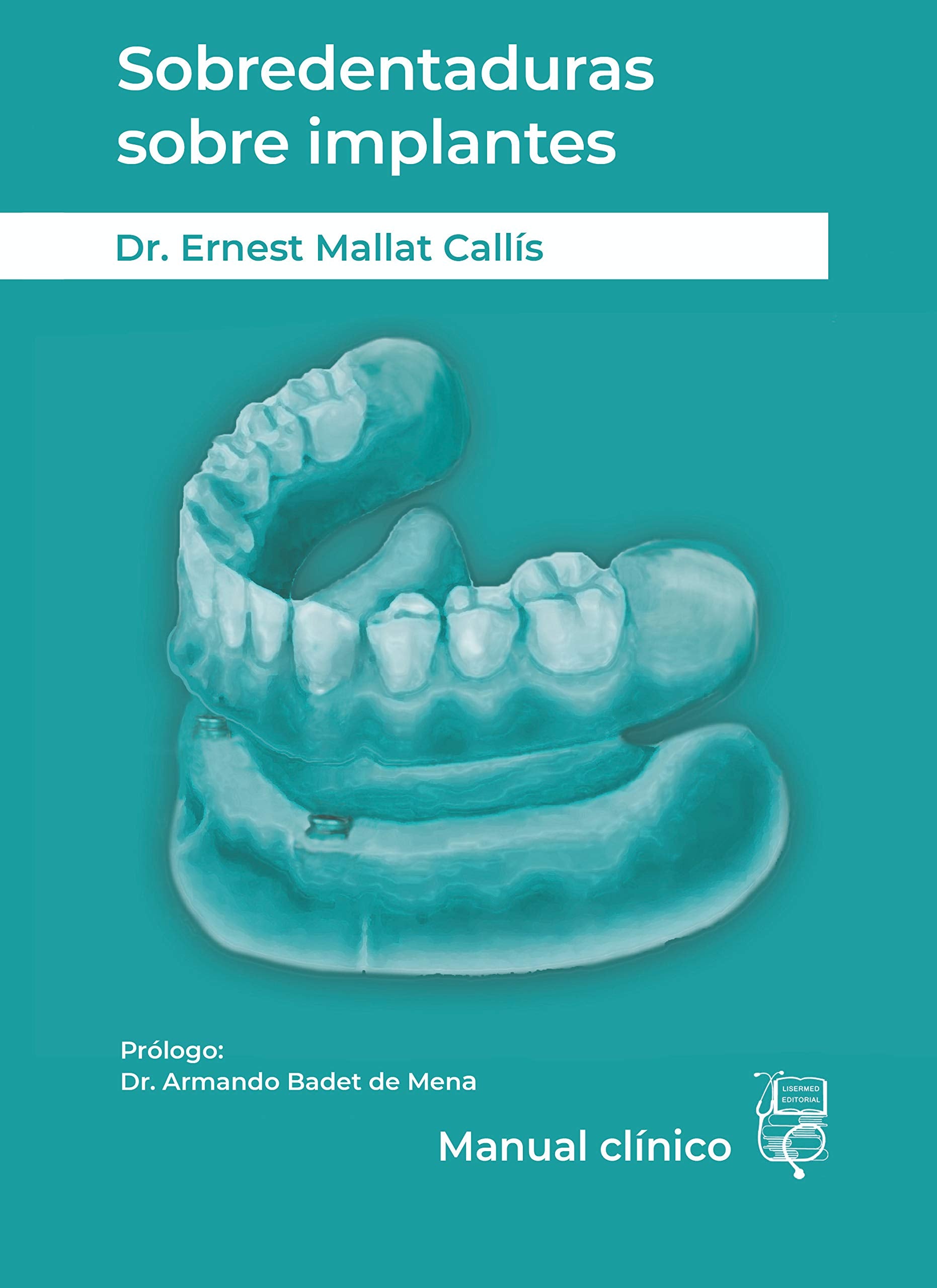 Libro: Sobredentaduras sobre implantes: Manual Clínico