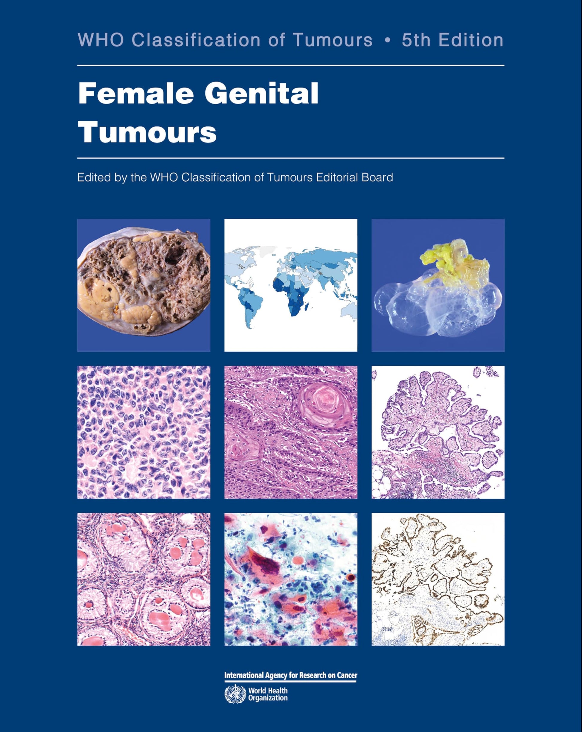 Libro: Female Genital Tumours: WHO Classification of Tumours (Medicine)