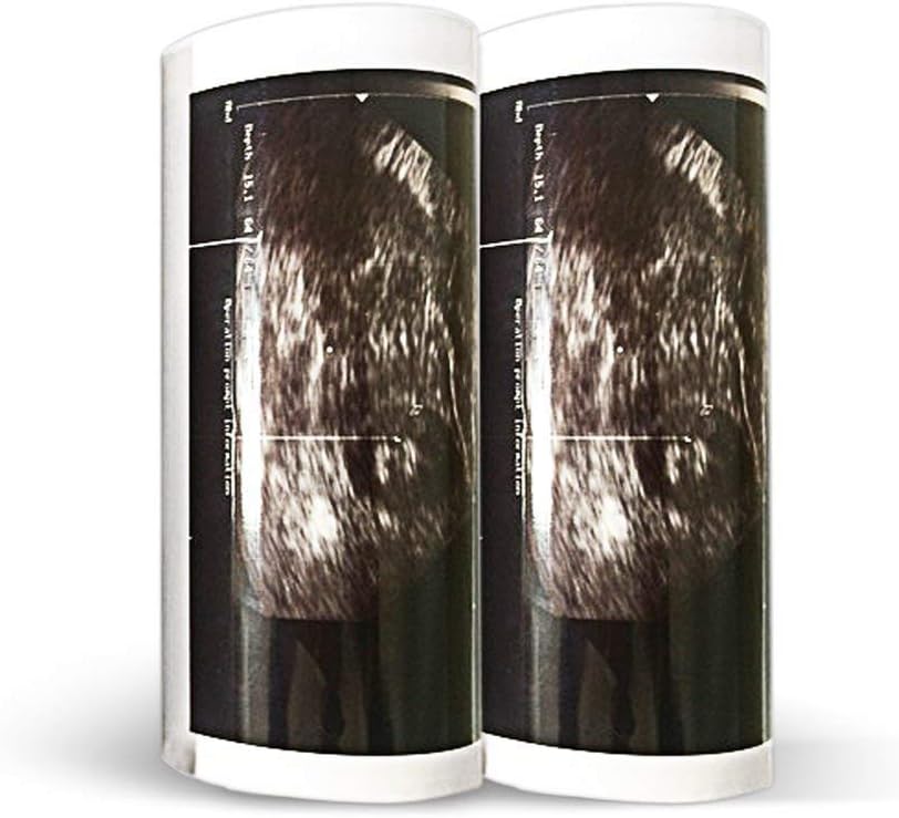 Papel de impresión térmica (110 mm x 20 m UPP-110S